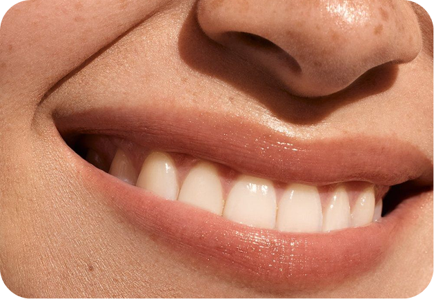 بعد از گذاشتن دندان مصنوعی چکار باید کرد؟